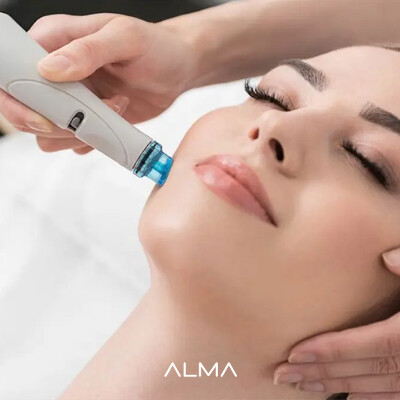 پاکسازی صورت در خانه یا کلینیک؟ کدام روش برای شما مناسب تر است؟