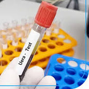 اوره چیست؟ کم یا زیاد شدن اوره در بدن نشانه چیست؟