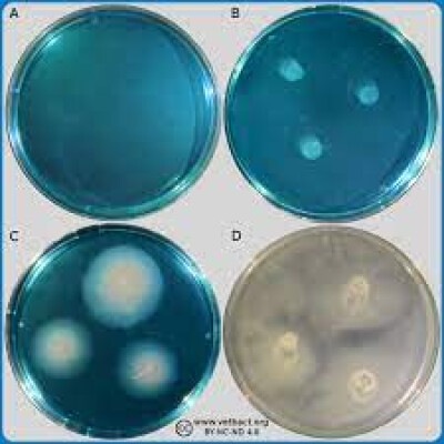 محیط نیمه جامد اصلاح شده راپاپورت واسیلیادیس