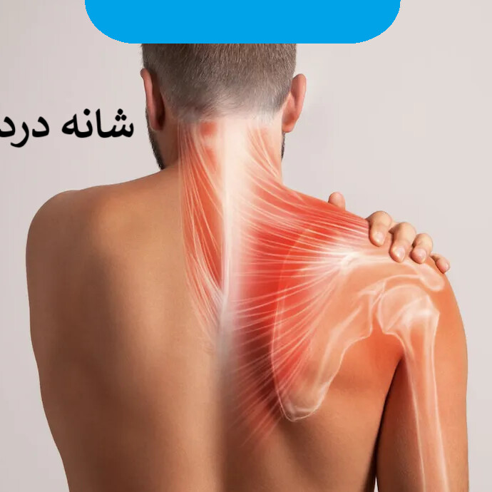 شانه درد: راهنمای جامع از پیشگیری تا درمان تخصصی